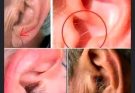 Did you know that if your ear hairs grow, it is because your body is … more